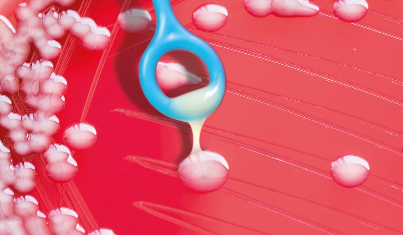 hvKp hypervirulent Klebsiellae pneumoniae