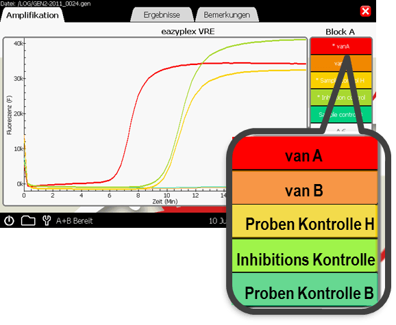 VRE VanA Kurve und Ergebnisse VRE VanA positives Ergebnis