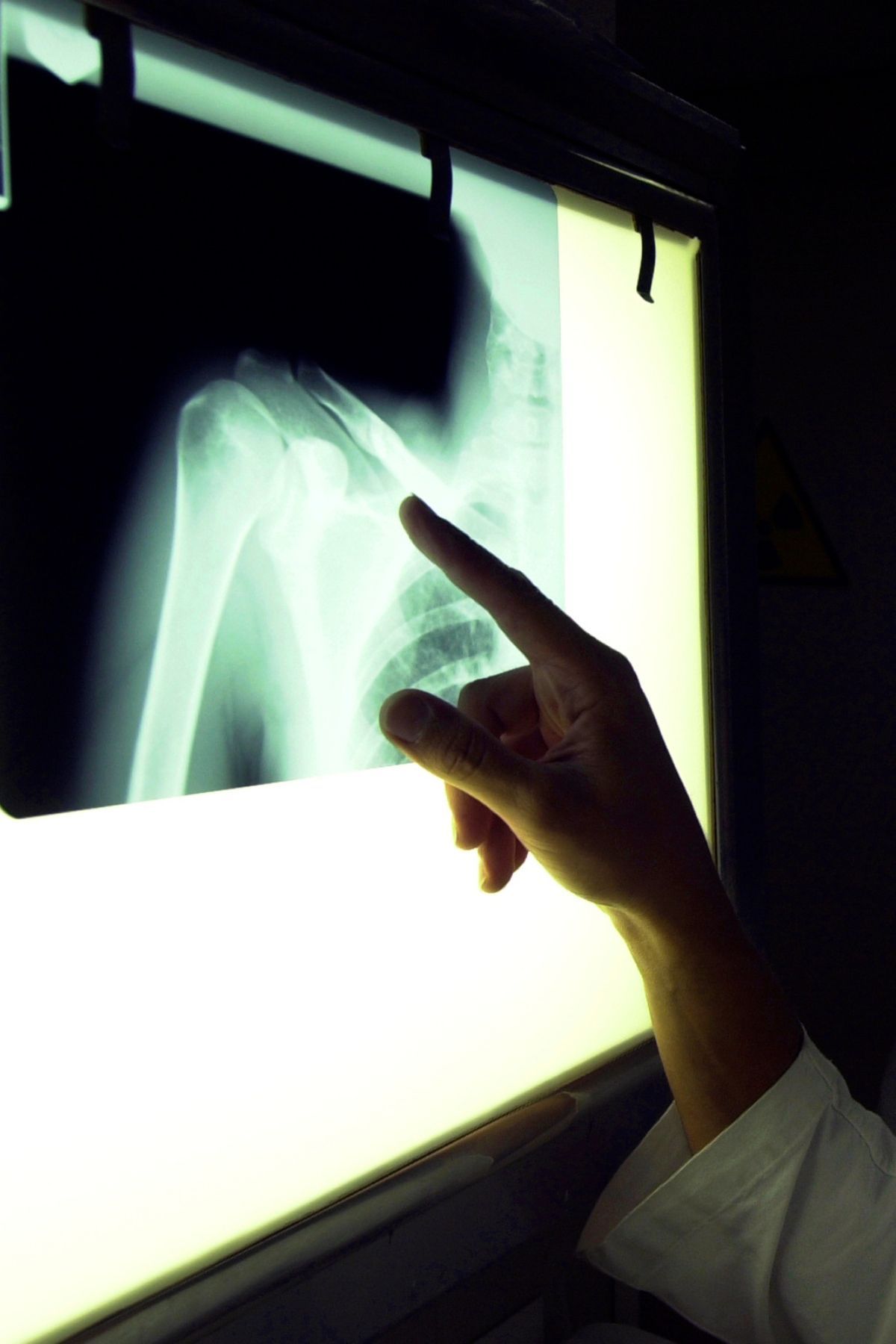 Bei der Analyse von Marketingmaßnahmen ist es wichtig, gründlich und systematisch vorzugehen, um wertvolle Erkenntnisse zu gewinnen und den Erfolg der Marketingstrategie zu bewerten. Hier sind einige wichtige Aspekte, die bei der Analyse von Marketingmaßnahmen zu beachten sind: 1. Klare Ziele: Definieren Sie klare Ziele für Ihre Marketingmaßnahmen, bevor Sie mit der Analyse beginnen. Die Ziele sollten spezifisch, messbar, erreichbar, relevant und zeitlich definiert sein (SMART). 2. Richtige Daten erfassen: Stellen Sie sicher, dass Sie die relevanten Daten erfassen, um die Leistung Ihrer Marketingmaßnahmen zu messen. Dies können Daten wie Website-Traffic, Konversionsraten, Klicks, Impressions, Social-Media-Interaktionen und andere Metriken sein. 3. Vergleich mit Benchmarks: Vergleichen Sie die Ergebnisse Ihrer Marketingmaßnahmen mit Branchenstandards oder vorherigen Leistungsdaten, um zu sehen, wie gut Sie im Vergleich zur Konkurrenz oder zu Ihren früheren Bemühungen abschneiden. 4. Attribution und Tracking: Nutzen Sie geeignete Analysetools, um die Wirkung Ihrer Marketingaktivitäten auf den Verkaufstrichter zu verfolgen. Dies ermöglicht eine bessere Zuordnung von Verkäufen und Conversions zu den entsprechenden Marketingkanälen. 5. Zielgruppenanalyse: Analysieren Sie, wie Ihre Zielgruppe auf Ihre Marketingmaßnahmen reagiert. Welche Zielgruppen zeigen das meiste Interesse, Engagement oder Kaufverhalten? 6. ROI-Berechnung: Berechnen Sie den Return on Investment (ROI) Ihrer Marketingmaßnahmen, um zu ermitteln, ob die investierten Ressourcen eine positive Rendite erzielen. 7. Zeitliche Betrachtung: Berücksichtigen Sie die zeitliche Entwicklung der Ergebnisse. Manche Marketingmaßnahmen können einen längeren Vorlauf benötigen, bis sie ihre volle Wirkung entfalten. 8. A/B-Tests: Führen Sie A/B-Tests durch, um verschiedene Varianten Ihrer Marketingmaßnahmen zu vergleichen und herauszufinden, welche besser funktionieren. 9. Interpretation der Daten: Die Analyse ist nicht nur das Sammeln von Daten, sondern auch das Interpretieren und Verstehen der Ergebnisse. Lehren Sie aus den gewonnenen Erkenntnissen und ziehen Sie Schlussfolgerungen für zukünftige Maßnahmen. 10. Kontinuierliche Verbesserung: Nutzen Sie die Analyseergebnisse, um Ihre Marketingstrategie kontinuierlich zu optimieren und anzupassen. Die Marketinglandschaft ändert sich ständig, daher ist es wichtig, flexibel zu bleiben und sich weiterzuentwickeln. Die regelmäßige und gründliche Analyse von Marketingmaßnahmen ist entscheidend, um den Erfolg Ihrer Marketingstrategie zu maximieren und auf Veränderungen im Marktumfeld angemessen reagieren zu können.