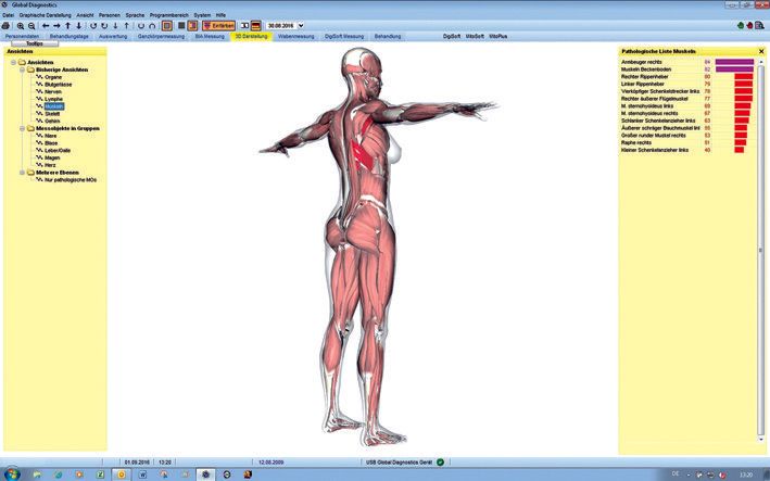 3-D-Darstellung Muskeln