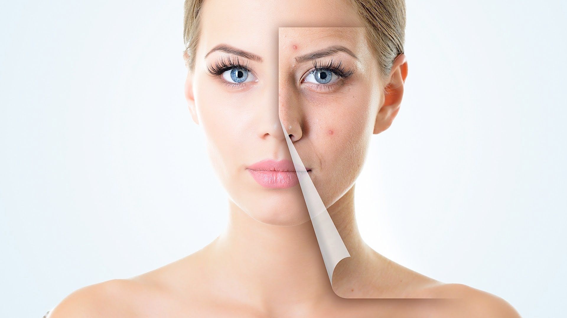 Blemish removal, vein removal, tag removal, Norwich,High Grade House Norwich