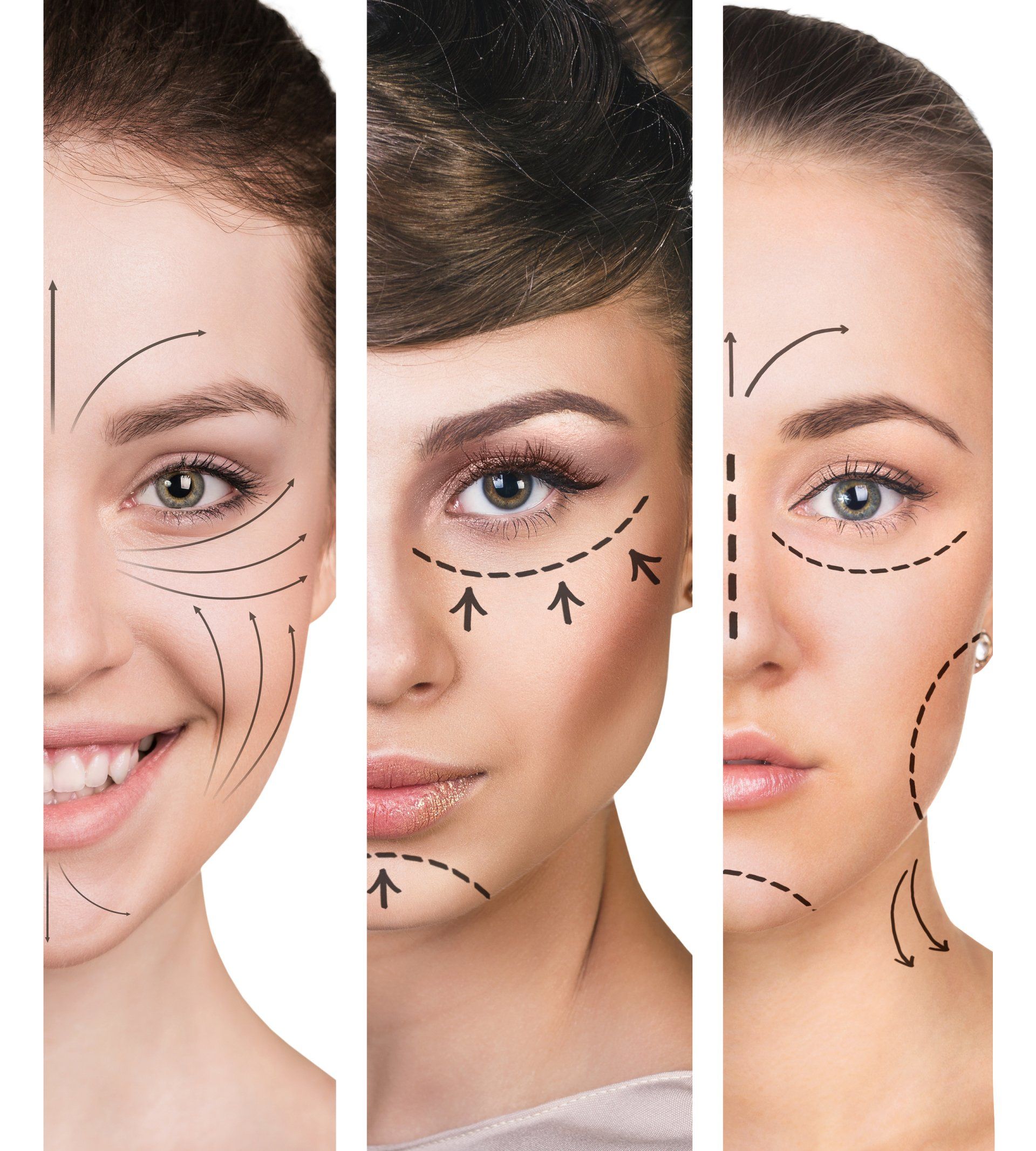 Permanent Makeup, HIFU, Facial, Skin, Acne, Blemish Removal, Laser Hair Removal, Clinic, Norwich