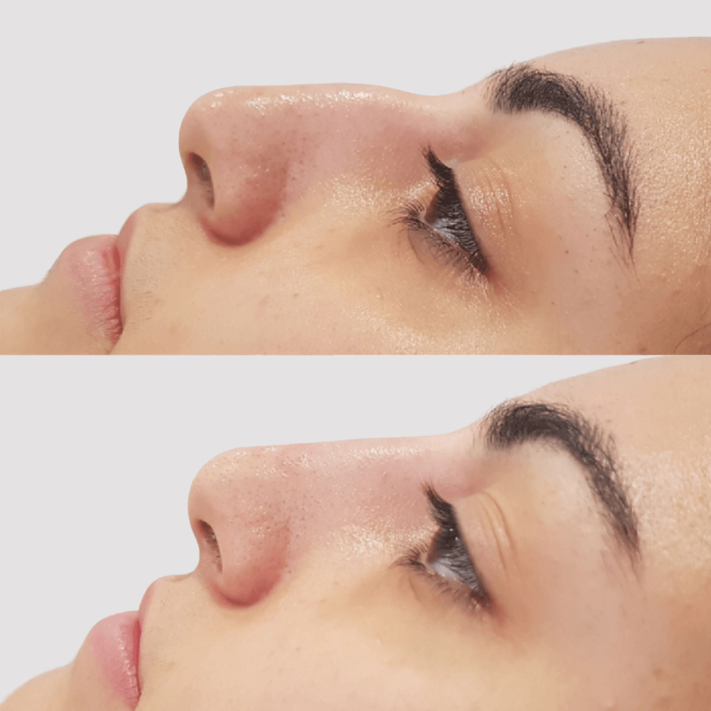 Permanent Makeup, Facial, Skin Clinic, Norwich