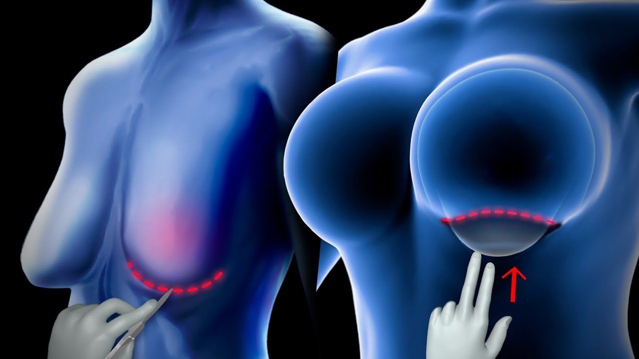 IPL skin treatment in Norwich