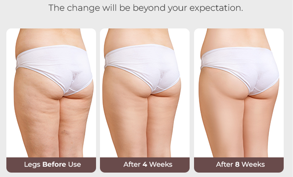 Permanent Makeup, HIFU, Facial, Skin, Acne, Blemish Removal, Laser Hair Removal, Clinic, Norwich