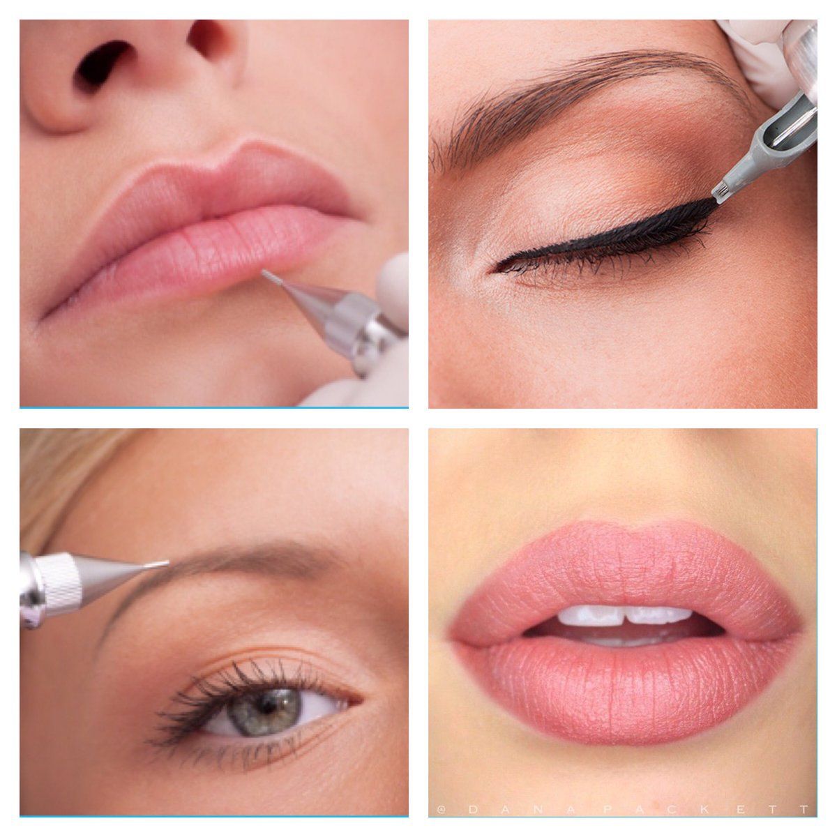Permanent Makeup, HIFU, Facial, Skin, Acne, Blemish Removal, Laser Hair Removal, Clinic, Norwich