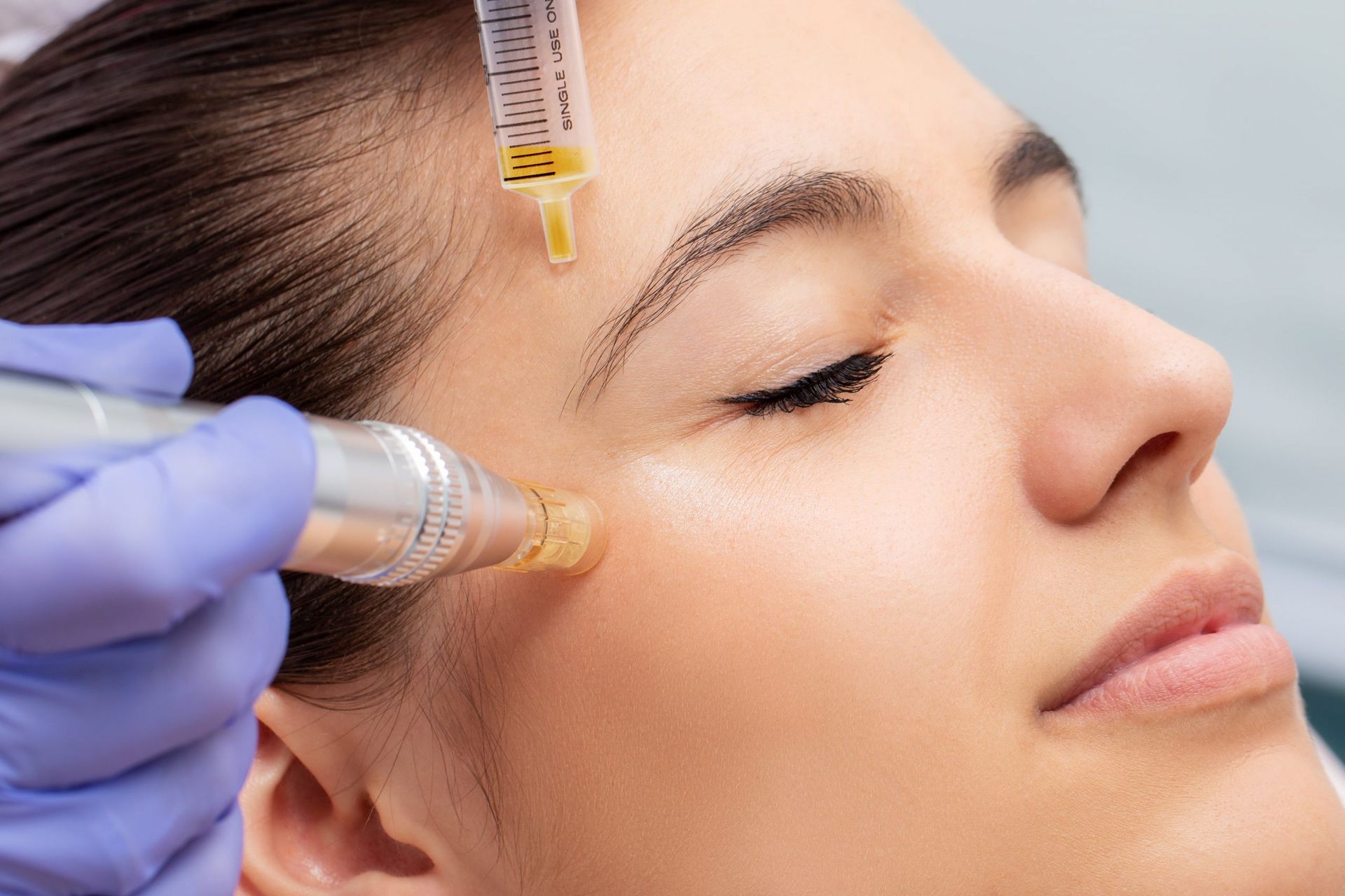 Mesotherapy treatment in Norwich