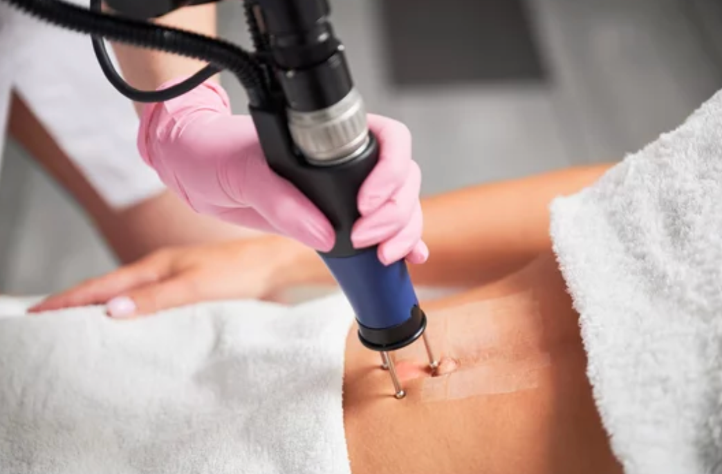 CO2 Fractional laser , High Grade House, Norwich