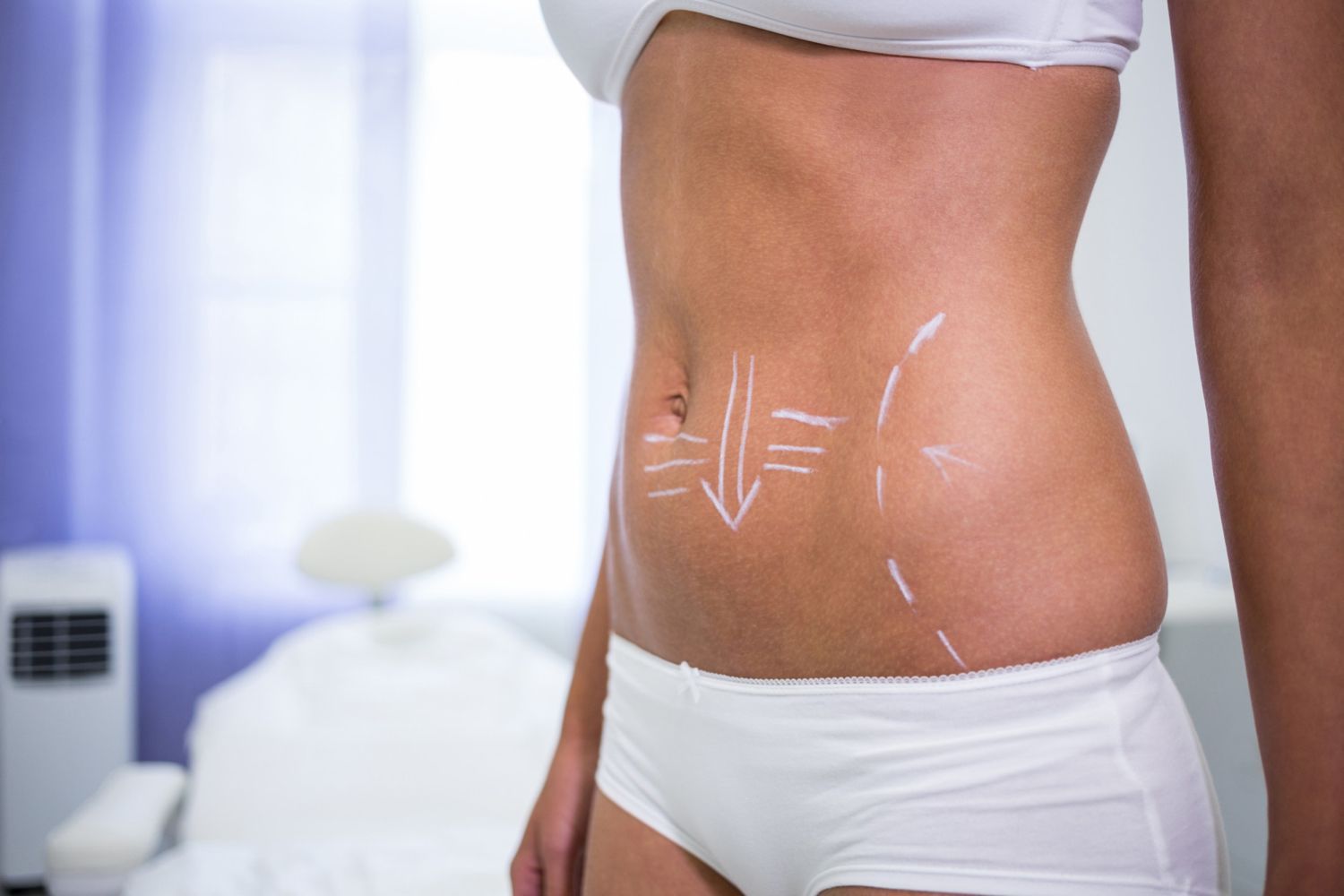 IPL skin treatment in Norwich