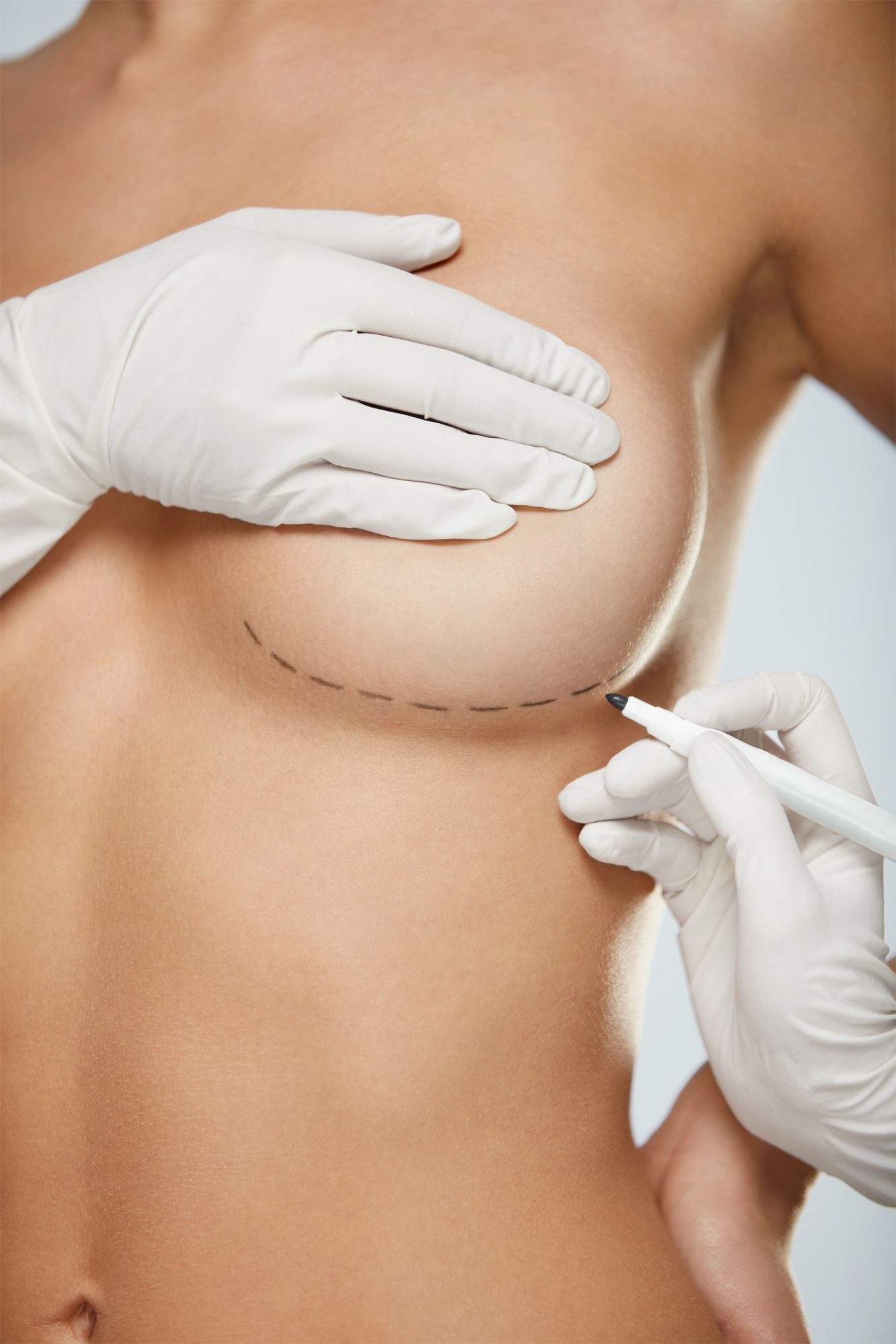 Breast  Implant Surgery