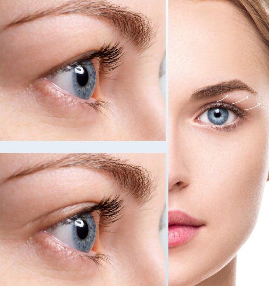 Permanent Makeup, HIFU, Facial, Skin, Acne, Blemish Removal, Laser Hair Removal, Clinic, Norwich