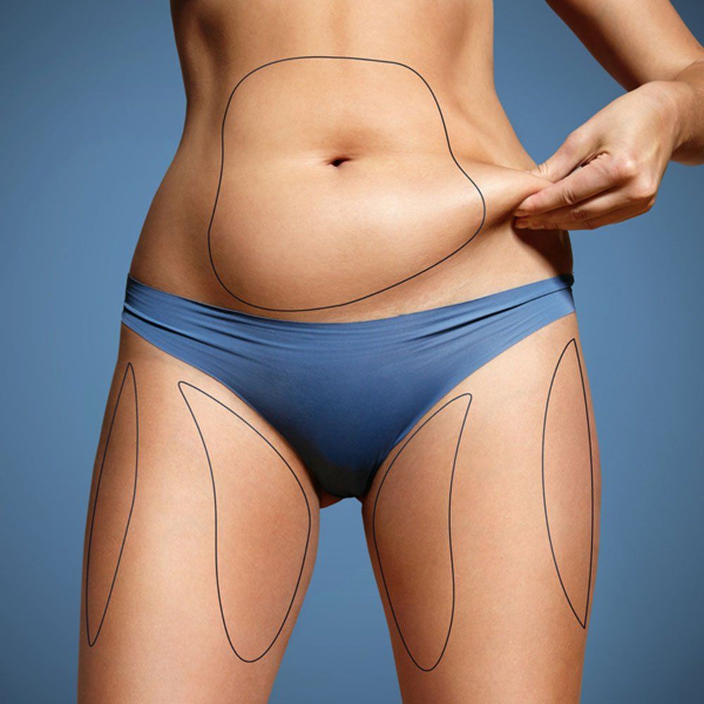 Cavitation slimming,High Grade House Norwich