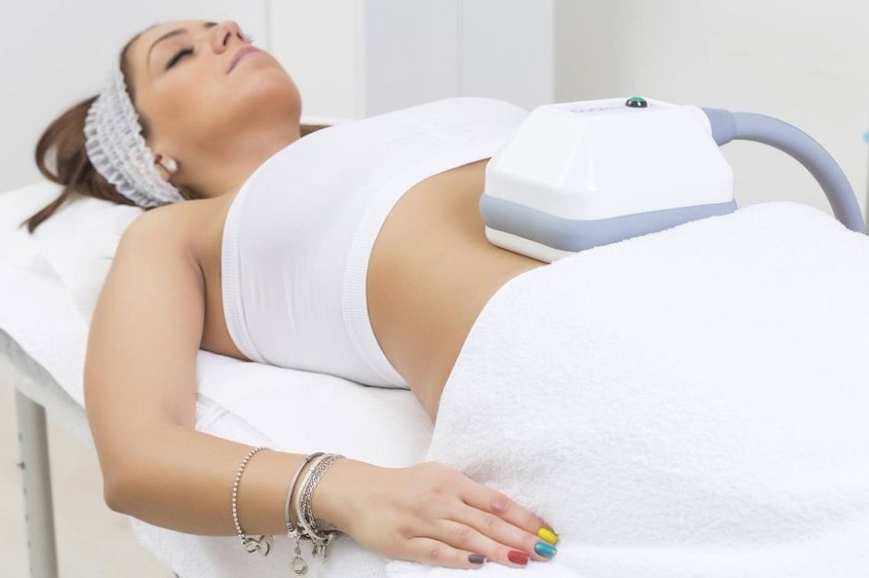 CRYOLIPOLYSIS-FAT-FREEZING