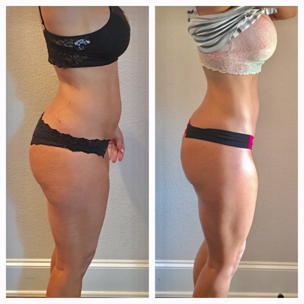 Cavitation slimming, High Grade House Norwich