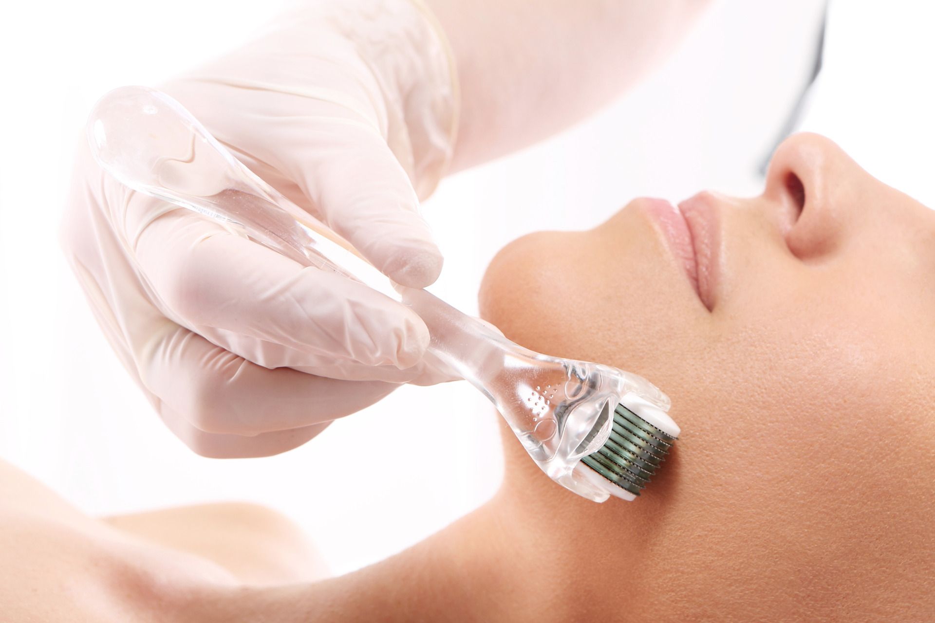 Microneddling, Derma rolling, Fractional Micro-needling, Norwich