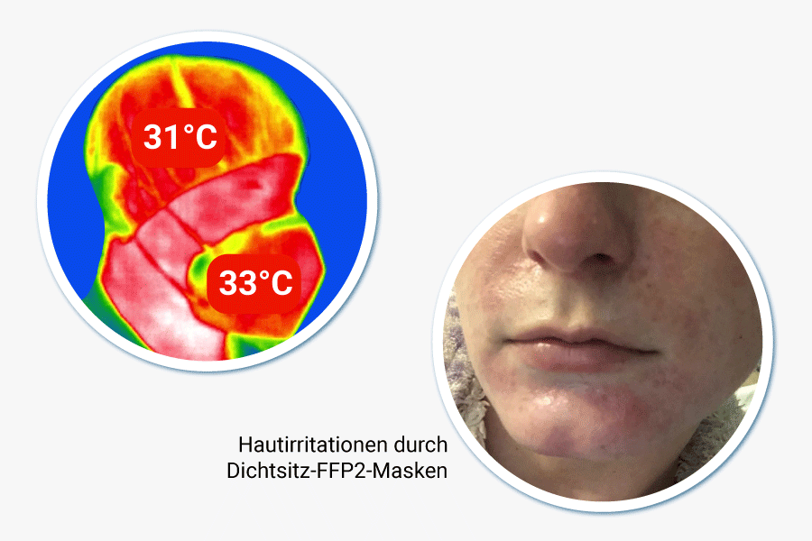Quelle: Website RKI zu gesundheitlichen Auswirkungen von FFP2 Masken ohne Ventil:  Verhindert Hautirritation