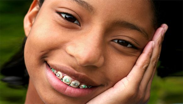 freundlich lächelnde, junge Patientin mit ästhetischer Zahnspange stützt sich auf eine Hand. / ein IONOS Bild