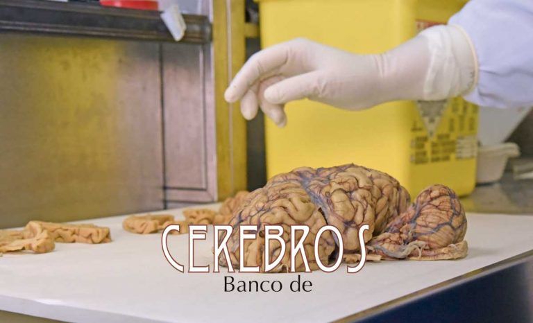Imagen de un cerebro BANCO DE CEREBROS