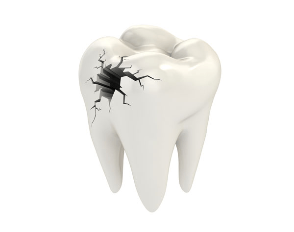 Odontología conservadora