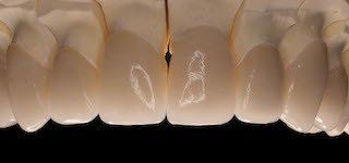Estética dental