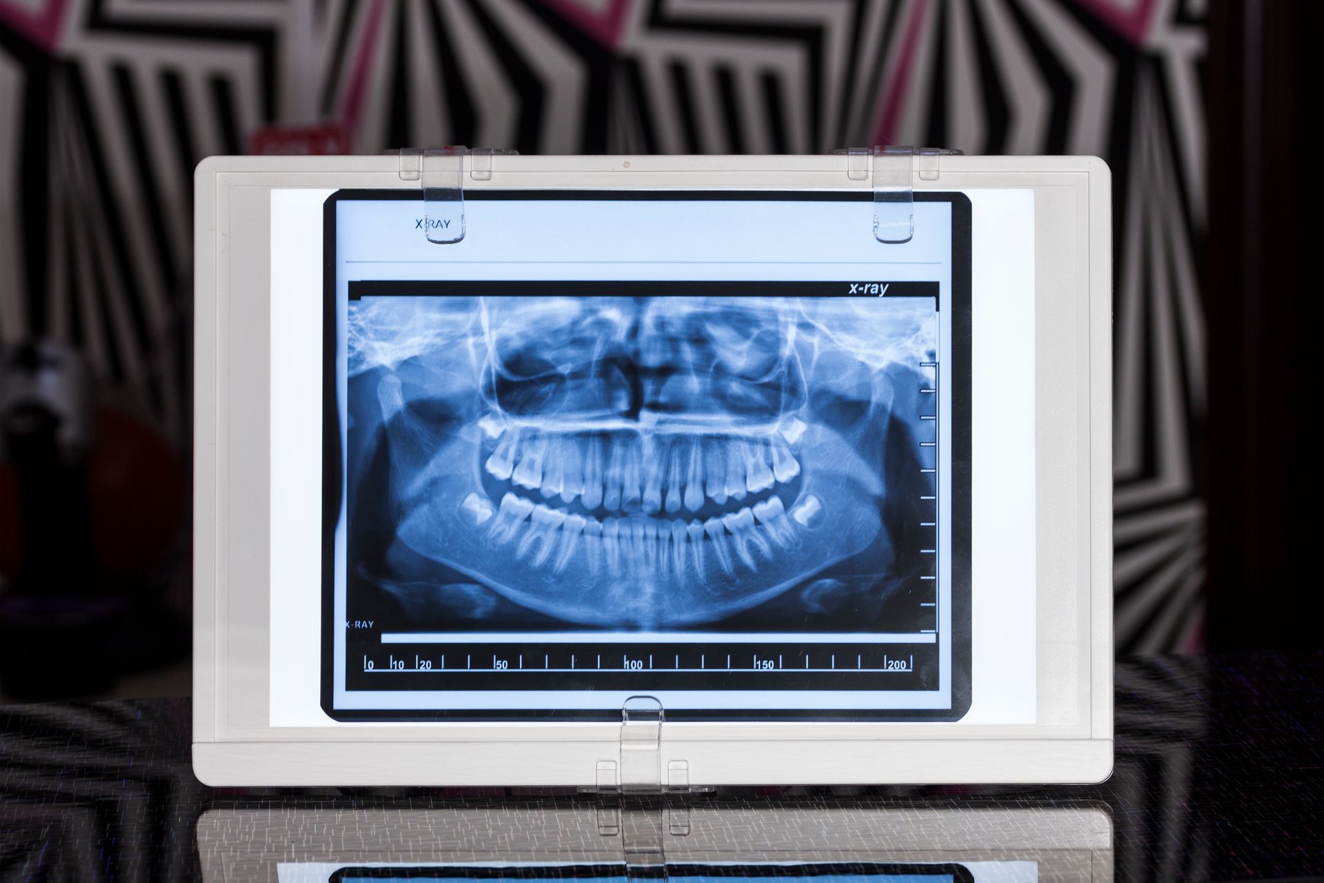 Radiovisiografía digital