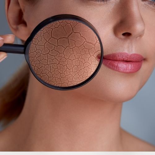 Problèmes de peau Problèmes de peau