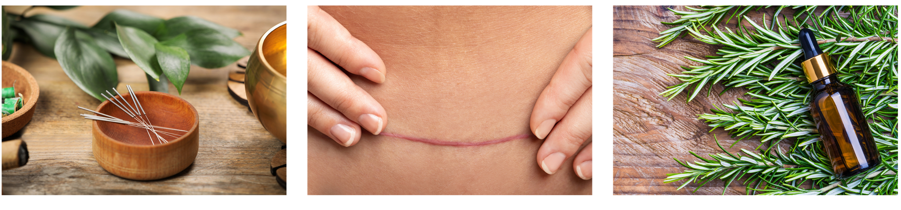 Was tun bei schmerzenden spannenden Narben...