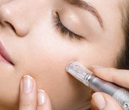 Microneedling Facial | EG Aesthetics | Benfleet