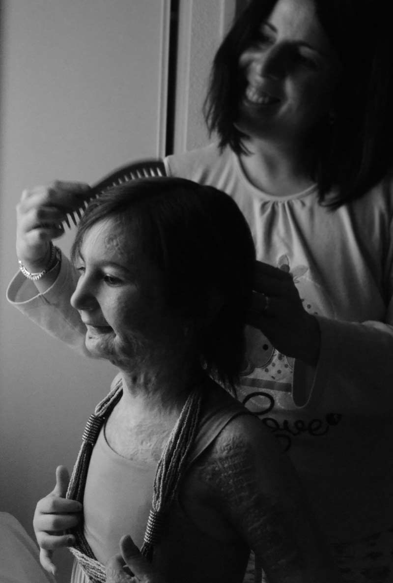 Ana Maria Little Superheroes - Child Burn Survivors