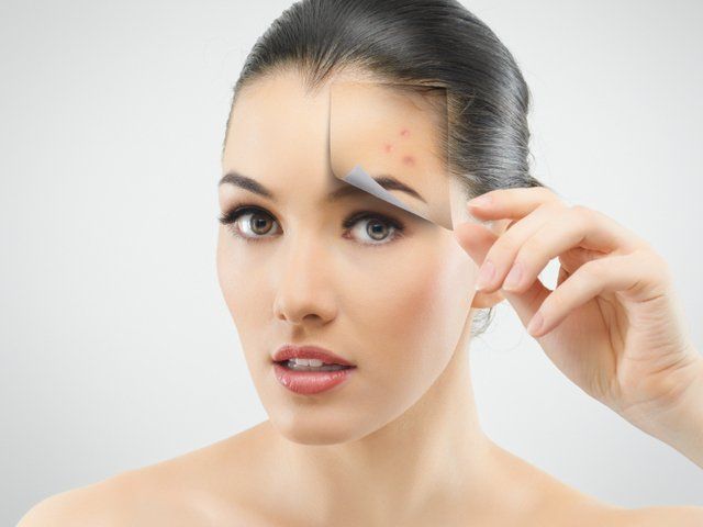 Traitement des taches à Bussy Saint Georges par le Dr Fidalgo, par peeling, Microneedling ou Laser