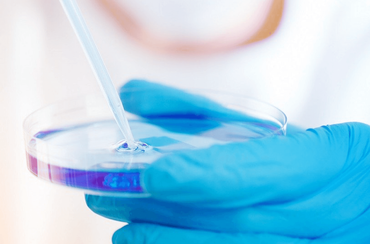 Mikrobiologische Untersuchung auf Schadstoffe und krankmachende Keime Mikrobiologische Untersuchung auf Schadstoffe und krankmachende Keime