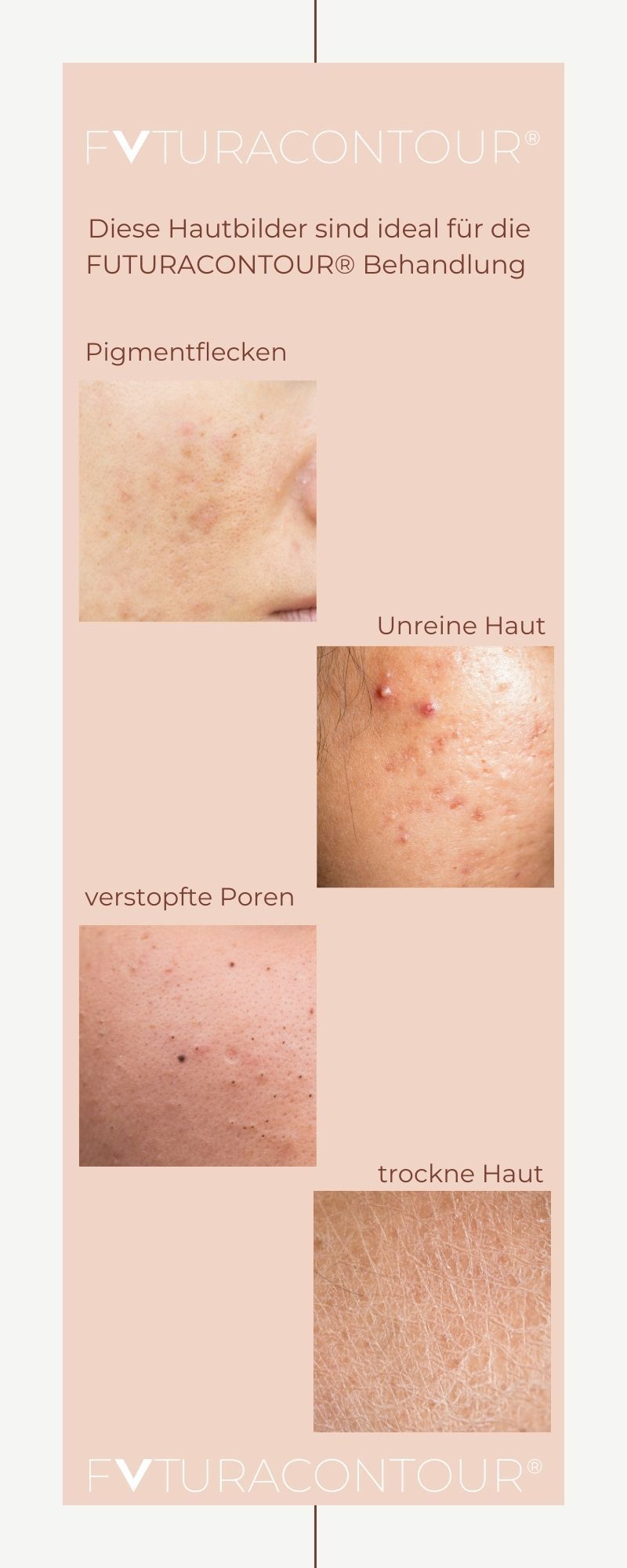 Ideale Hautbilder für Behandlung Ideale Hautbilder für Behandlung