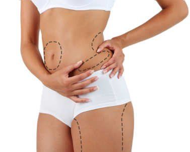 Optimieren Sie Ihre Figur Kryolipolyse