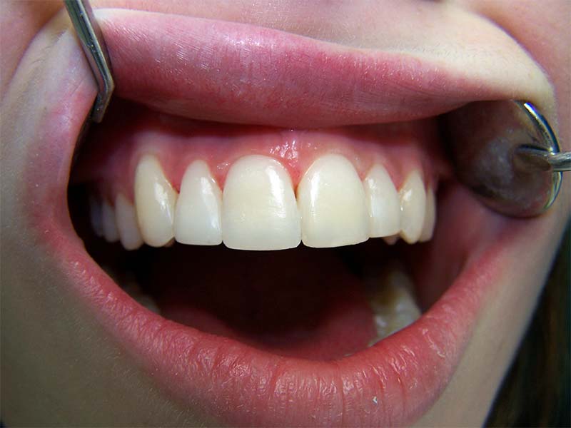 aesthestische Zahnheilkunde