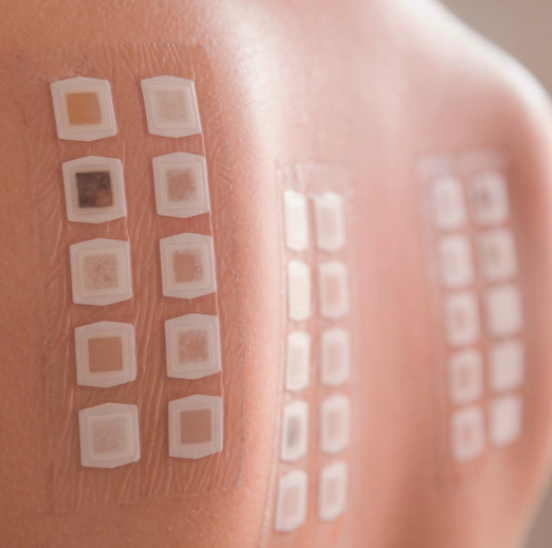 Allergy Testing, pediatrics, nut allergy, allergy season