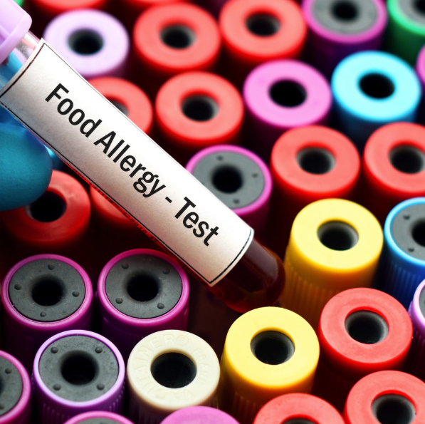 Allergy Testing, pediatrics, nut allergy, allergy season