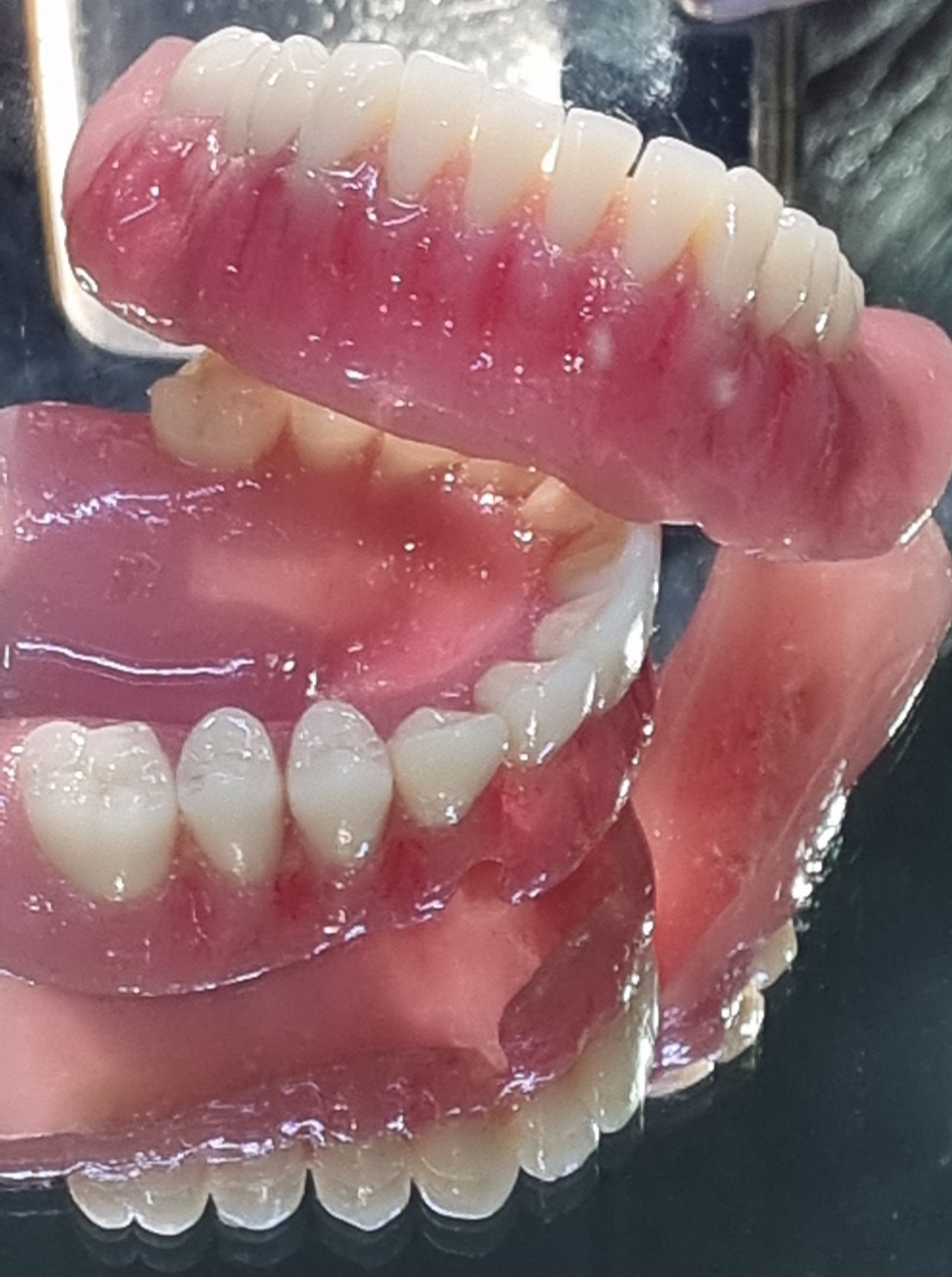 dentures completed