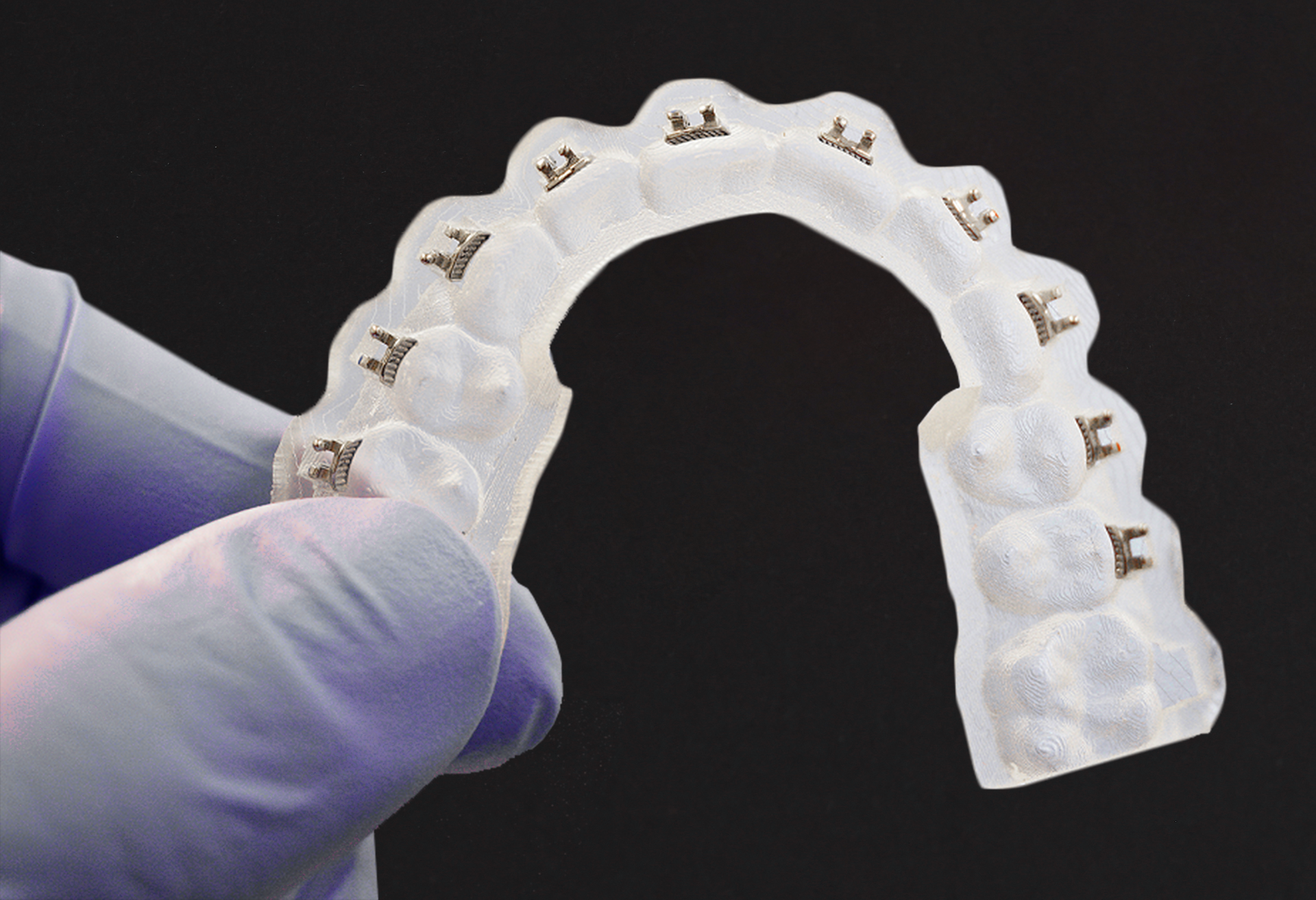 indirect bonding tray