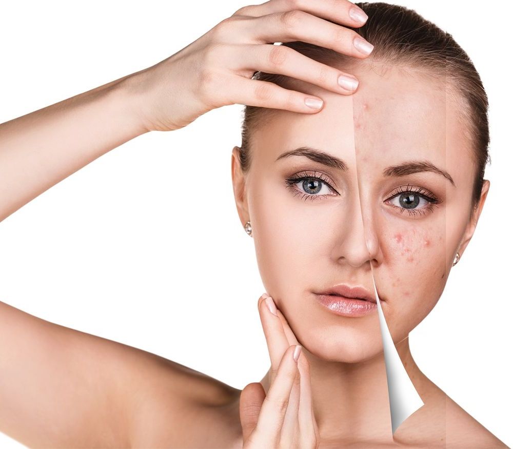 Das 1a Kosmetik Studio in Bad Saulgau: Ute Rau fuer Permanent Make-up, Hautverjuengung, Fusspflege, Manikuere, Hochzeiten, Akne-Behandlung, Herren Kosmetik