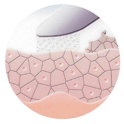 Mikrodermabrasion Gesichtsbehandlung im Kosmetikstudio HOUSE OF SHIDO in Hamburg Mikrodermabrasion Gesichtsbehandlung im Kosmetikstudio HOUSE OF SHIDO in Hamburg