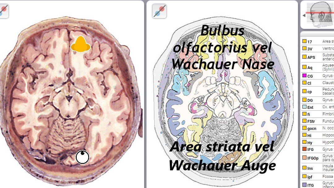 Wachauer Auge und Wachauer Nase