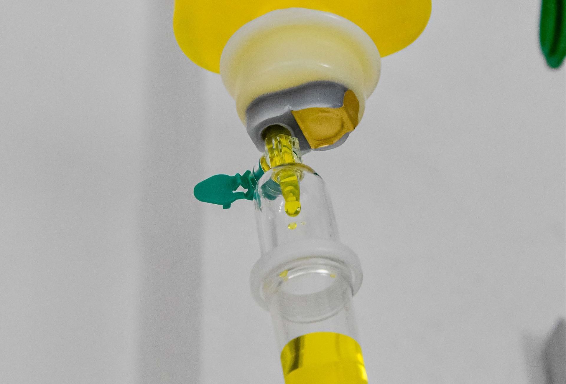 Infusionstherapie in Düsseldorf –
Vitalität und Wohlbefinden durch eine gezielte Zufuhr von Vitaminen, Mineralstoffen, Aminosäuren und Antioxidanzien. 
Geeignet bei einem Mangel an Vitaminen, Mineralstoffen, Spurenelementen und
  Aminosäuren, Patienten mit erhöhter Infektanfälligkeit, Patienten mit Leistungsschwäche und verminderter Regeneration, Patienten mit unausgewogener Ernährung, Patienten mit erhöhtem Stress, Sportler, Patienten mit mitochondrialer Fehlfunktionen (Dysfunktion), Patienten mit  Burnout, Antriebsschwäche, chronischem
 Erschöpfungssyndrom, Frauen mit unerfülltem Kinderwunsch.
Hochdosierte Infusion mit Vitamin C.