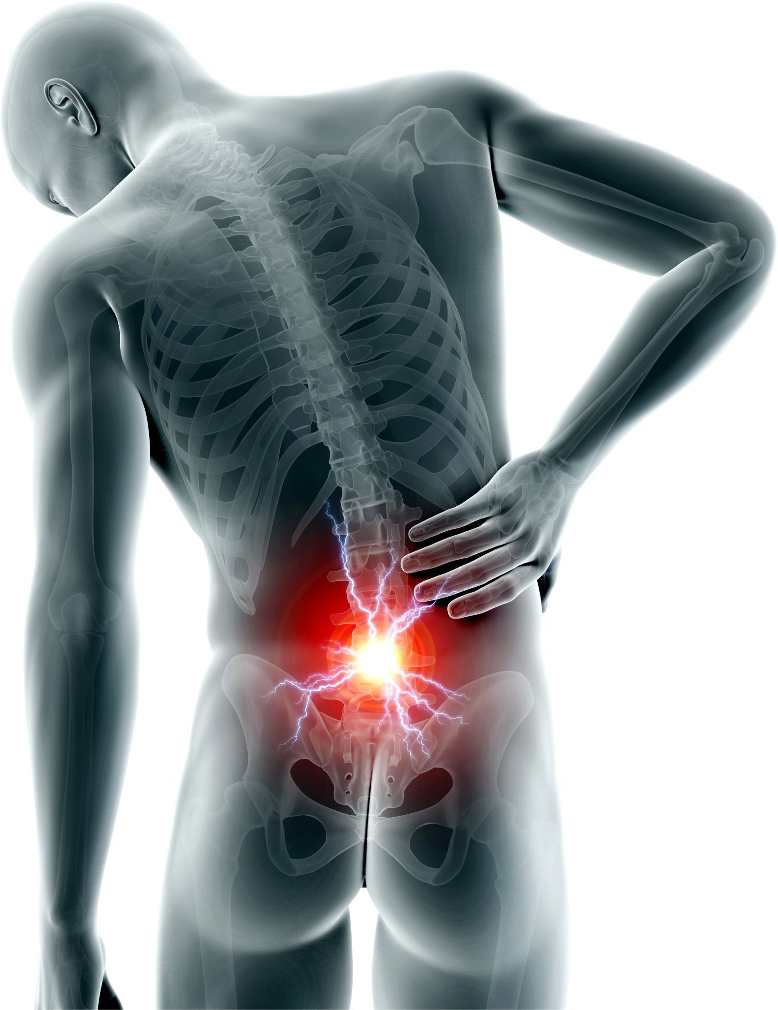 Back Pain