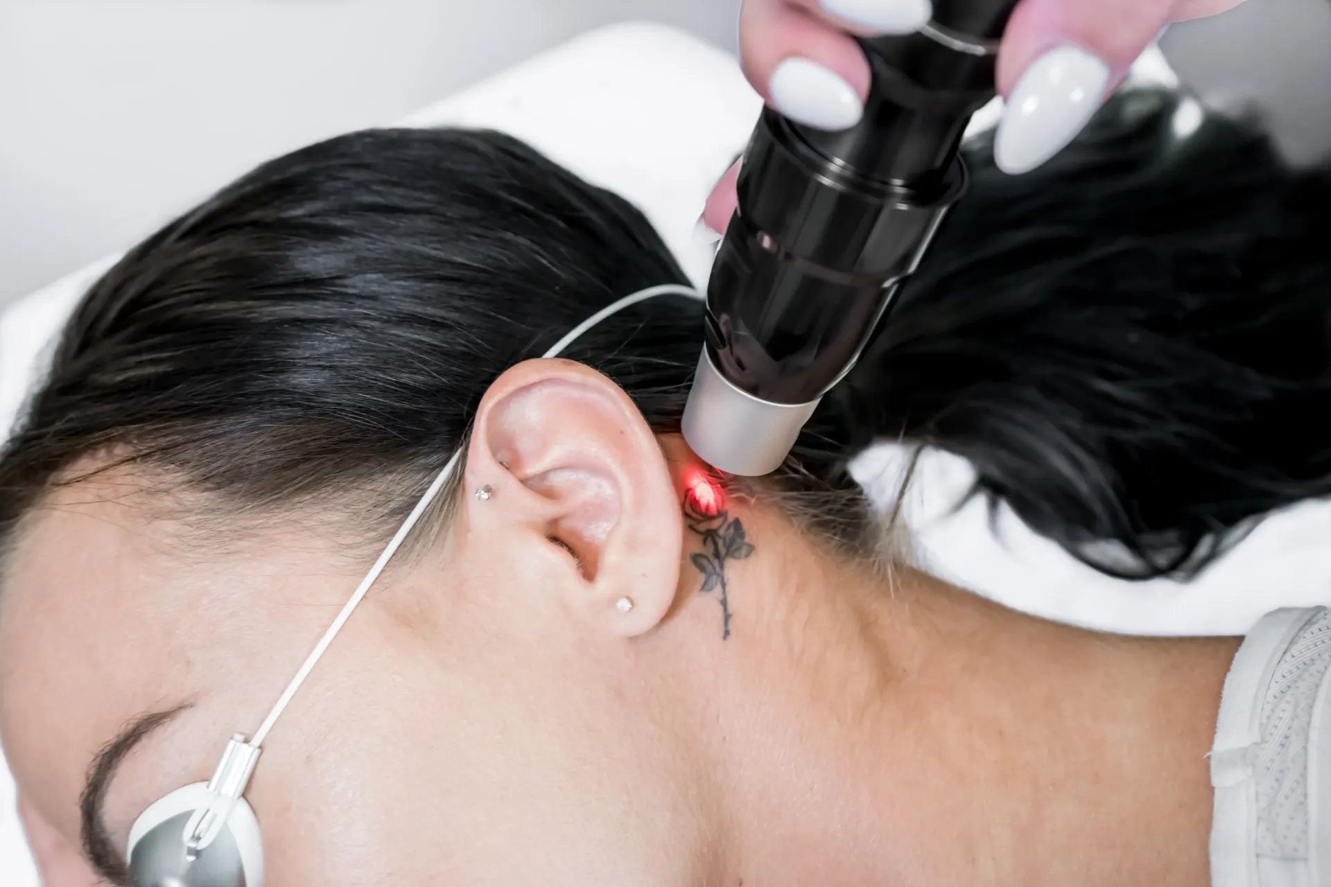 Eine Person liegt auf der Seite, ein roter Laserstrahl trifft die Haut hinter dem Ohr zur Entfernung eines blumenförmigen Tattoos