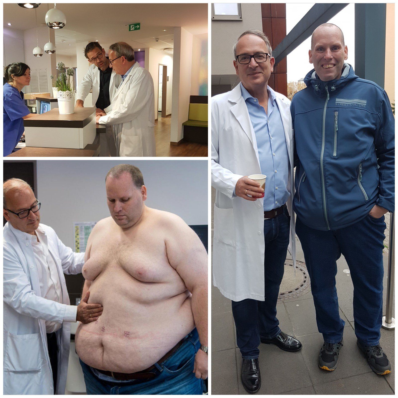 vorher nachher adipositaszentrum dr. staikov