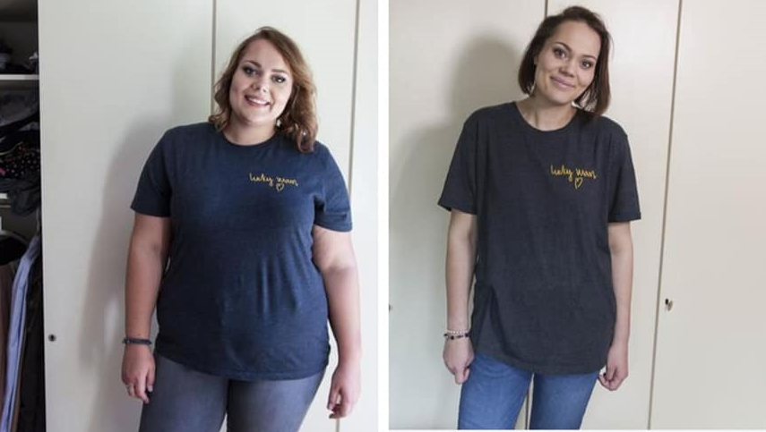 Adipositasoperation Magenbypass Sleeve Schlauchmagen MGB Bariatrie Staikov Abnehmen