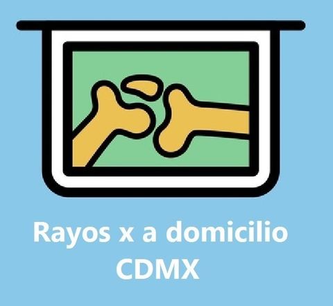 Toma de rayos x a domicilio en ciudad de México CDMX