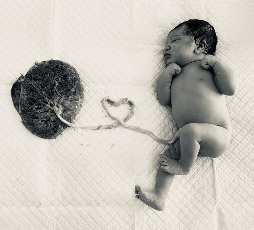 Baby still attached to placenta