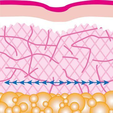 Fadenlifting, Mini Facelift, Brauenlift, Happy Lift, Gesichtsstraffung, Wangenlift Fadenlifting, Mini Facelift, Brauenlift, Happy Lift, Gesichtsstraffung, Wangenlift