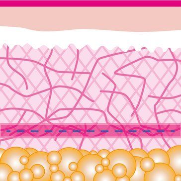 Fadenlifting, Faltenbehandlung, Gesichtsstraffung, Facelift Fadenlifting, Faltenbehandlung, Gesichtsstraffung, Facelift